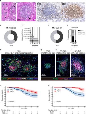 Low-dose radiotherapy promotes the formation of tertiary lymphoid structures in lung adenocarcinoma